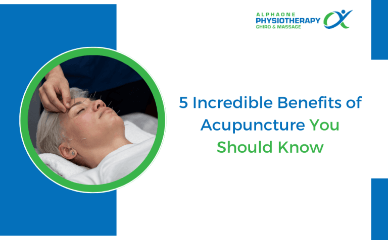 5 Incredible Benefits of Acupuncture You Should Know
