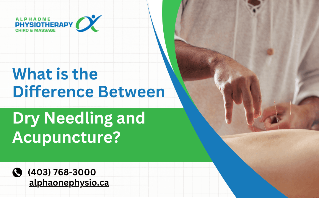What is the Difference Between Dry Needling vs Acupuncture